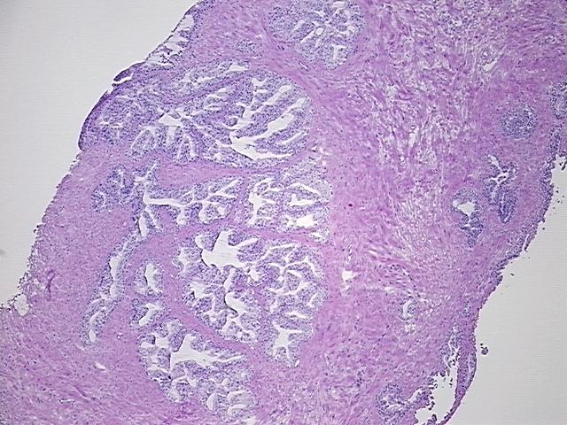 4x Image