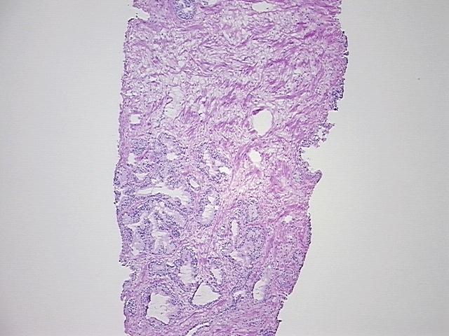 4x Image