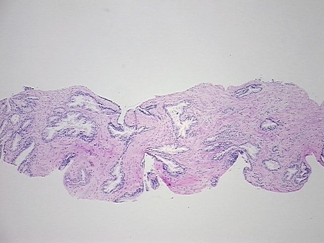 Tissue Sections (5x5um), FFPE; Prostate; Within normal