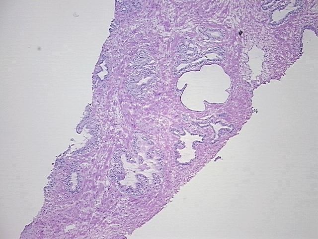 4x Image