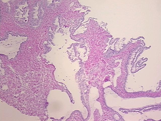 4x Image