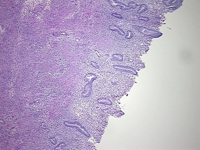 4x Image