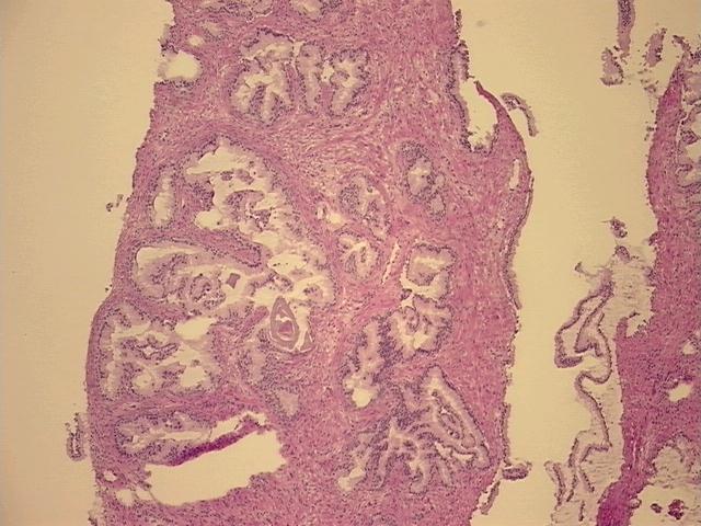 4x Image