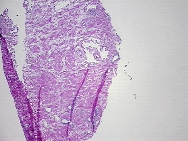 4x Image
