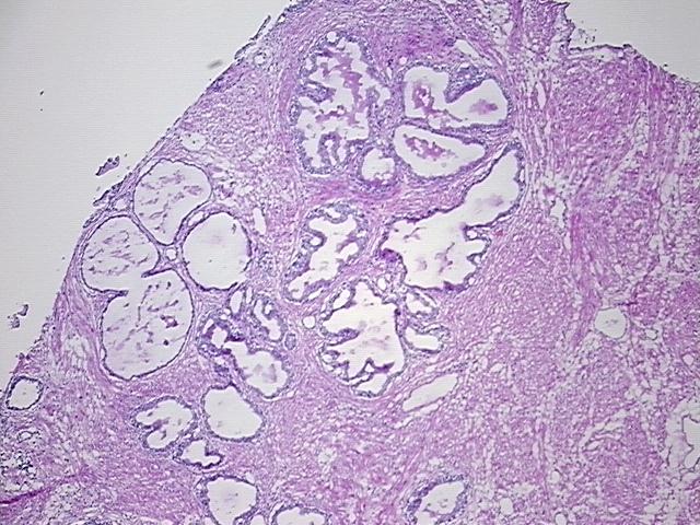 4x Image