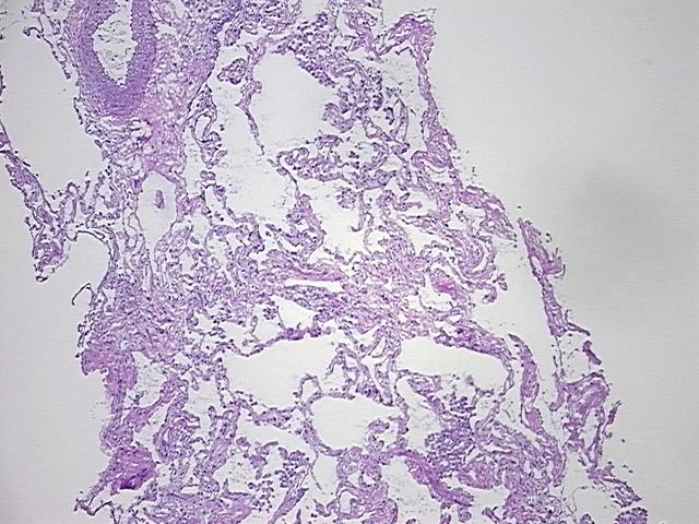 4x Image