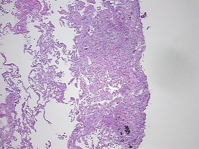 4x Image