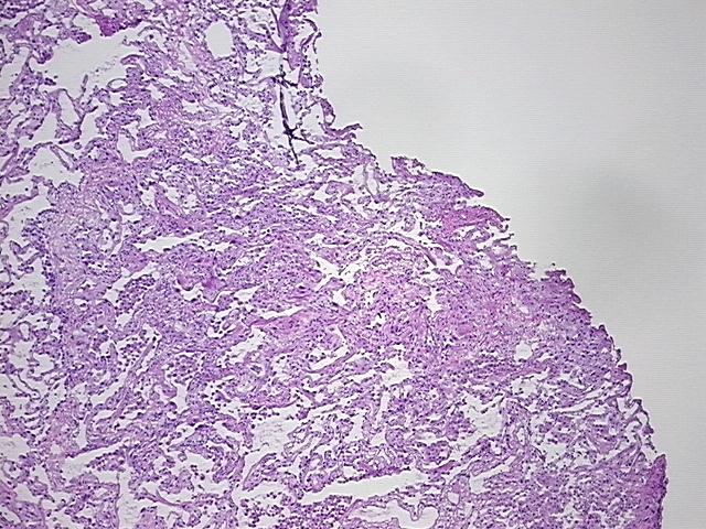 4x Image