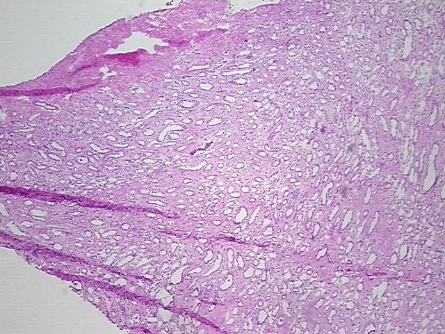4x Image