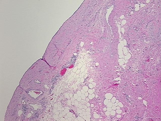 4x Image