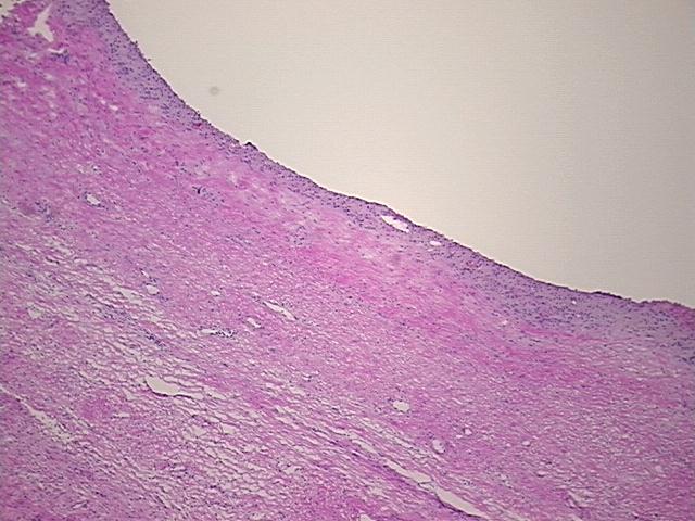 4x Image