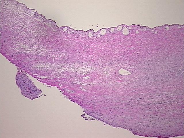 4x Image