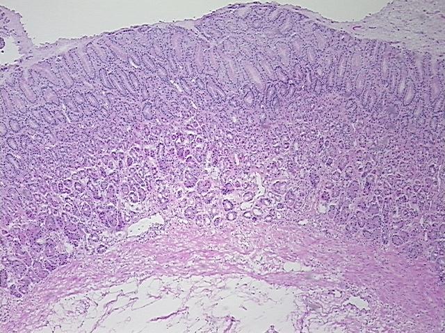 4x Image