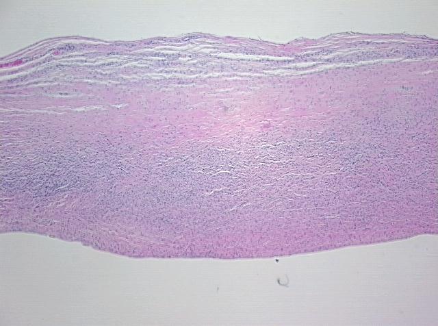4x Image