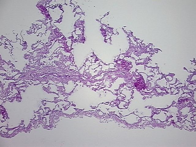 4x Image