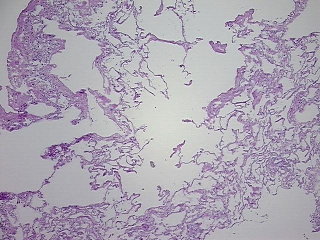 4x Image