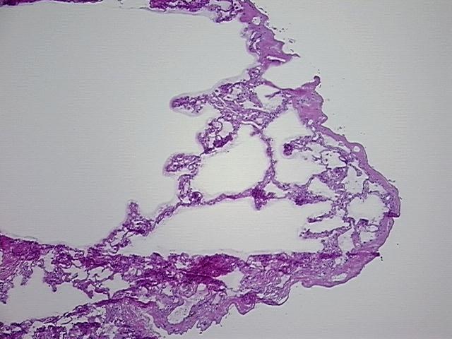 4x Image