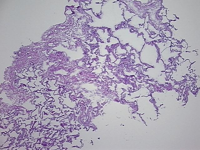 4x Image