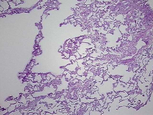 4x Image