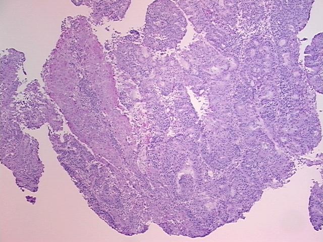 4x Image