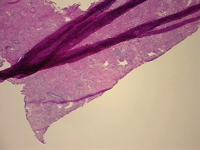 4x Image