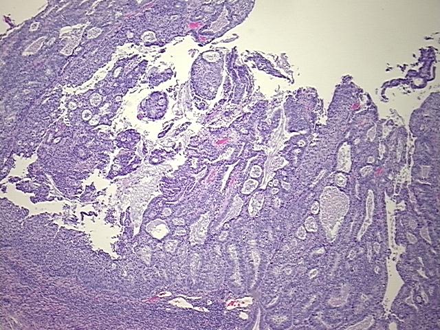 4x Image