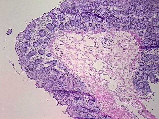 4x Image