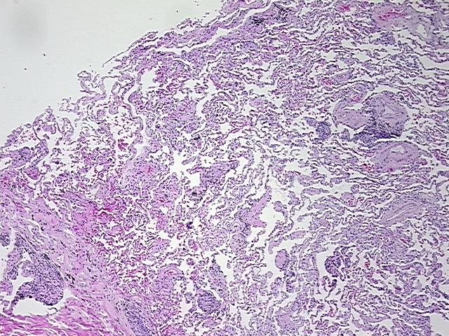 4x Image