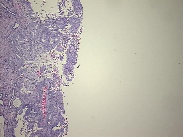 4x Image