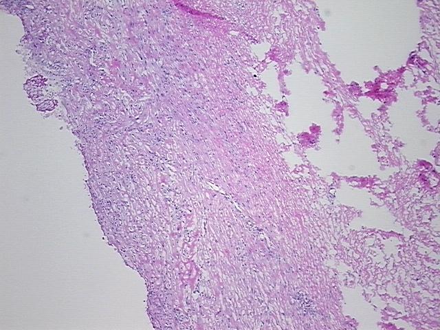 4x Image