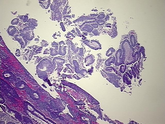 4x Image