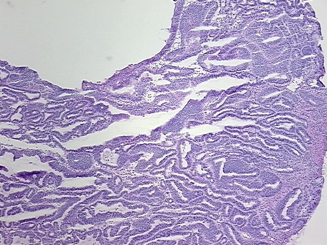4x Image