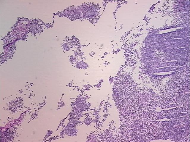 4x Image