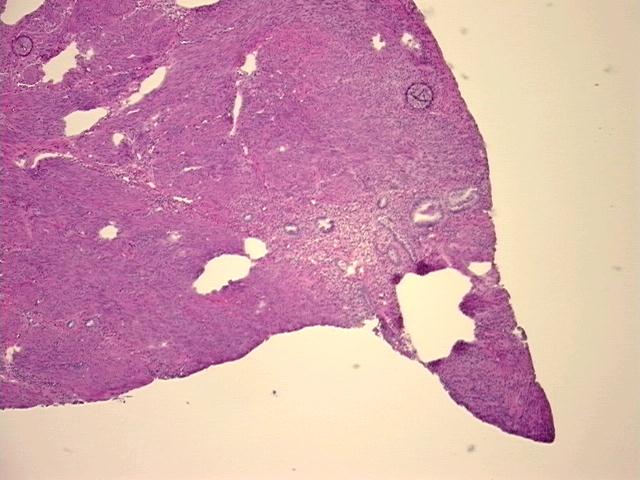 4x Image