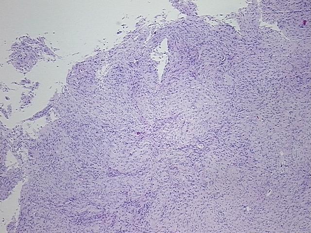 4x Image