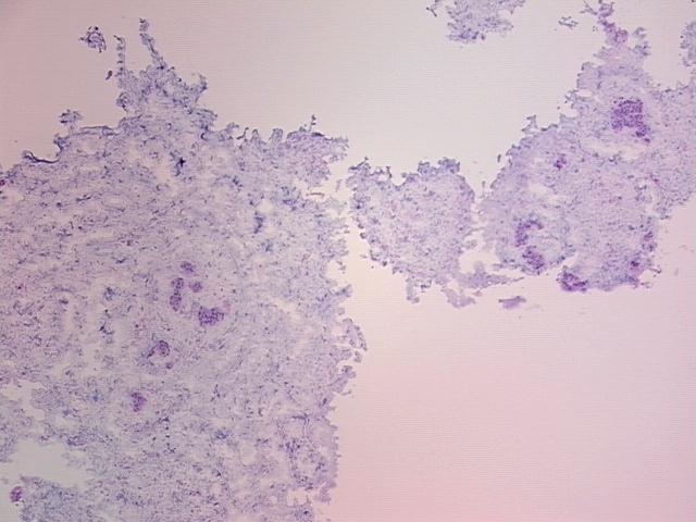 4x Image