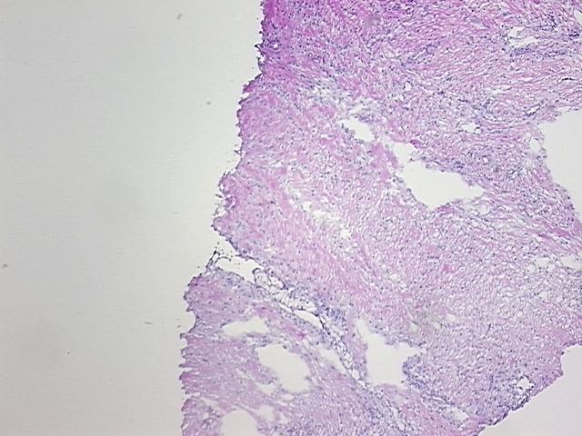 4x Image