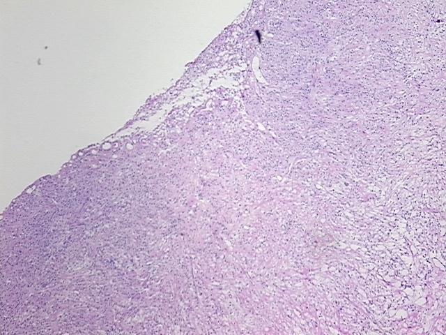 4x Image