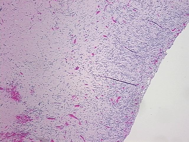 4x Image