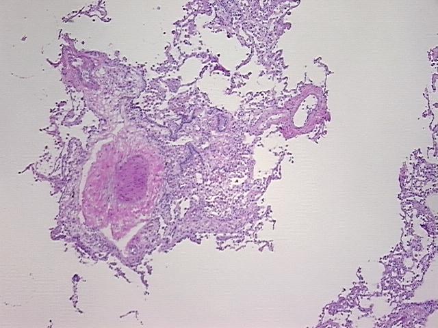 4x Image