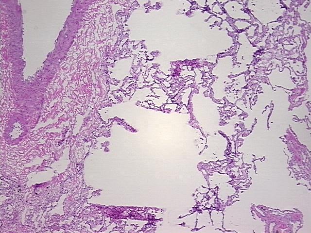 4x Image