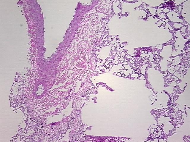 4x Image