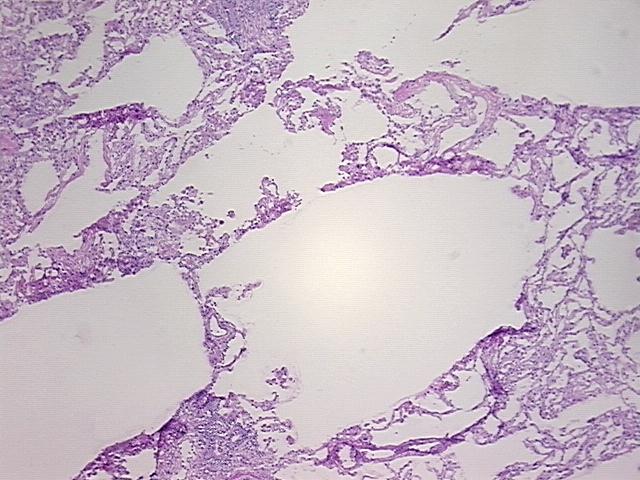 4x Image