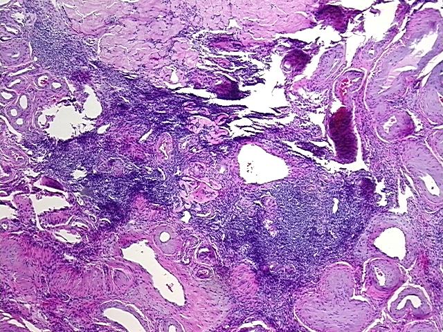 4x Image