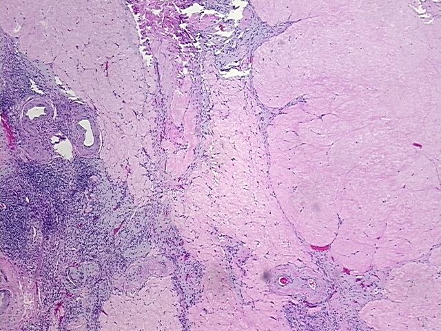 4x Image