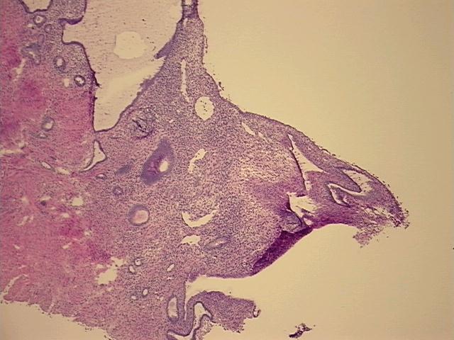 4x Image