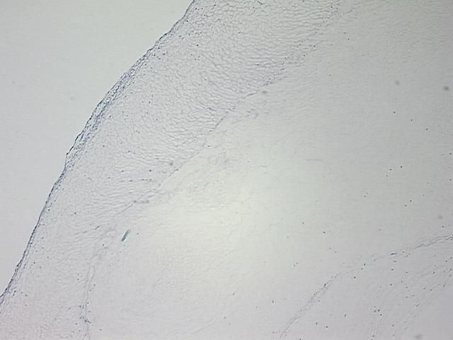 4x Image