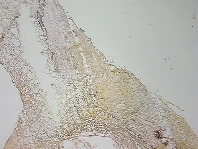 4x Image