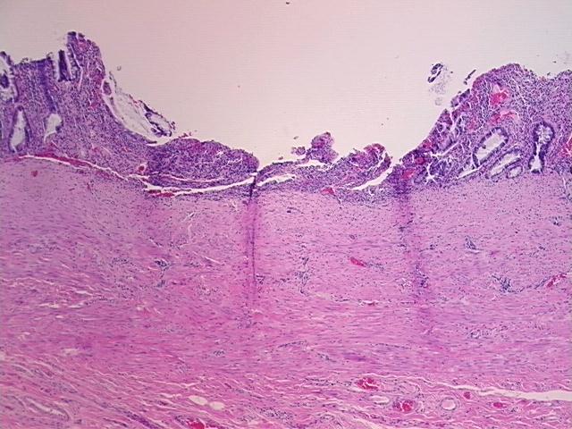 4x Image
