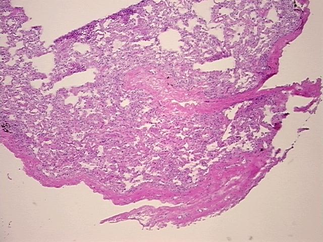 4x Image